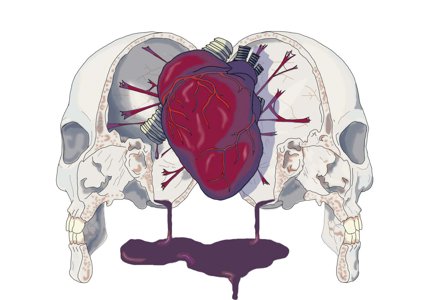 Headsplitter Sticker